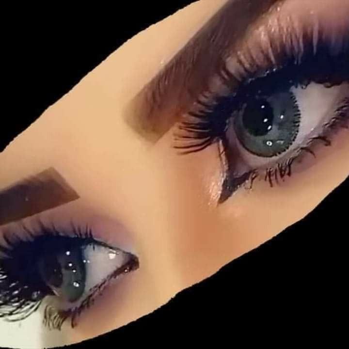 لوزه
